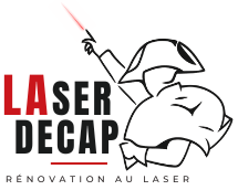 Laser Decap